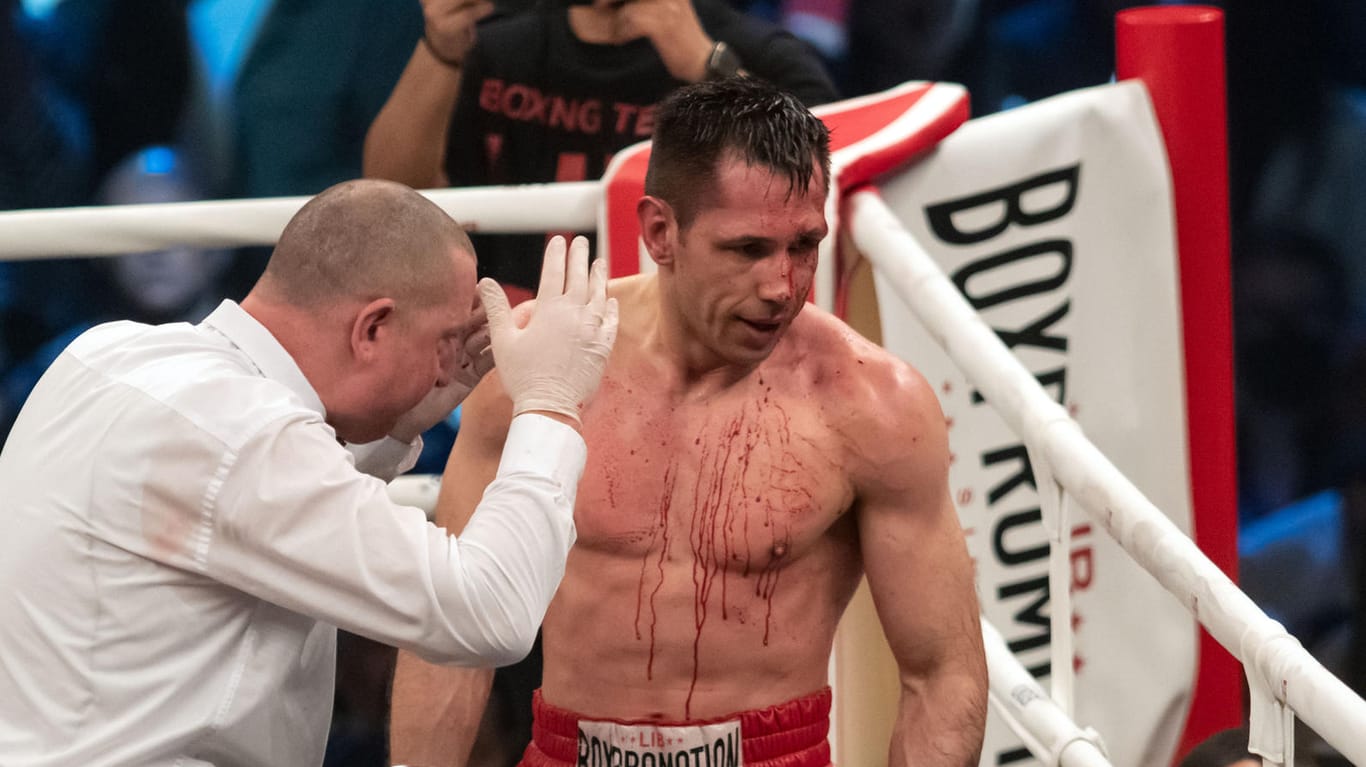Felix Sturm blutet am Kopf: Der Boxer verlor seinen Ausscheidungskampf.