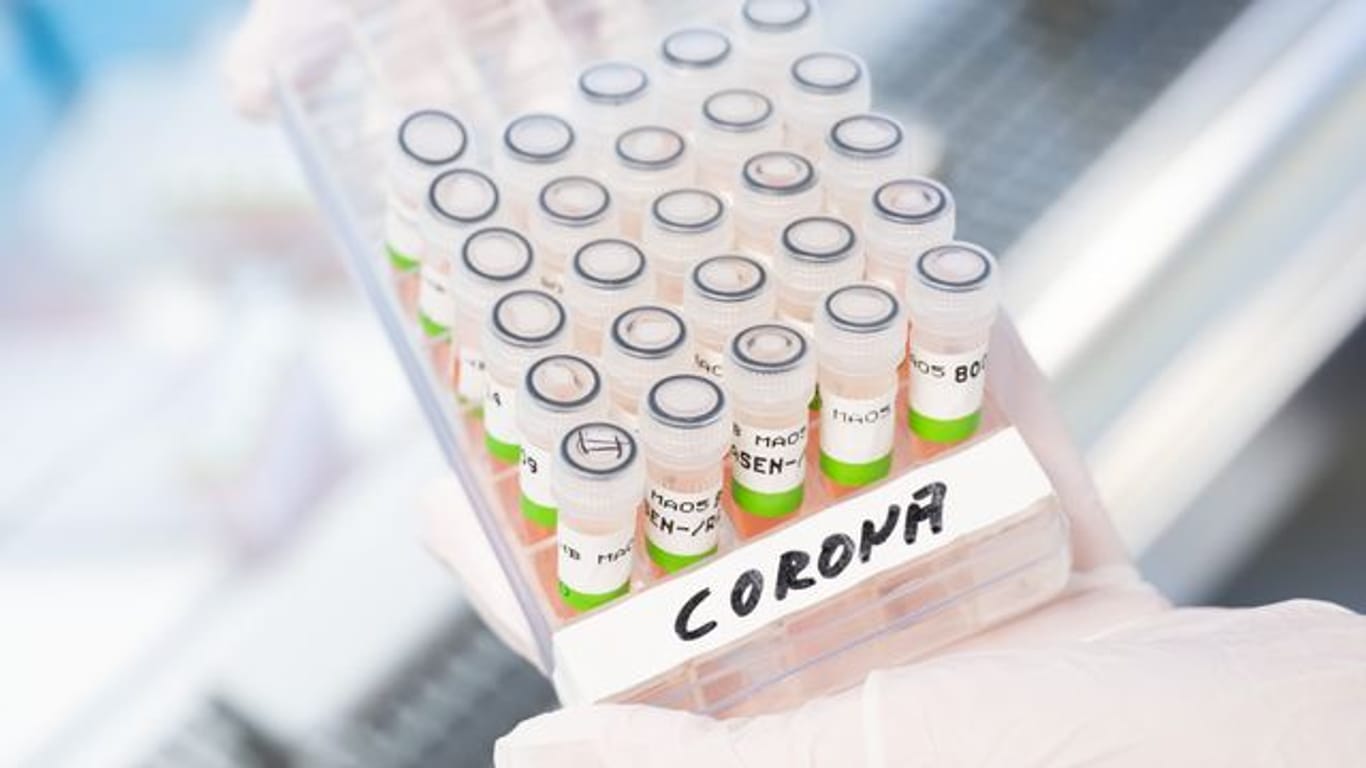 PCR-Tests im Labor (Archivbild): In einigen Teilen Sachsens sinkt die Inzidenz, gleichzeitig werden aber viele Corona-Fälle gar nicht mehr erfasst.