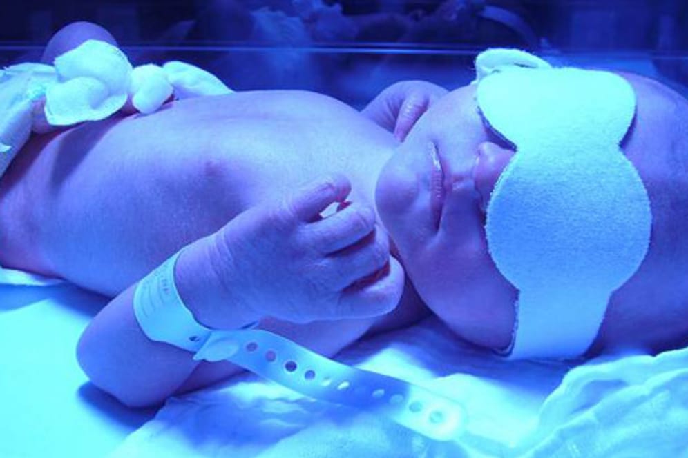 Neugeborenes bei der Phototherapie.