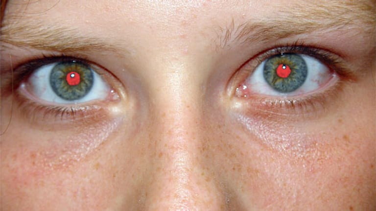 Hier sehen wir, das direktes Blitzlicht für Portraits alles andere als optimal ist.