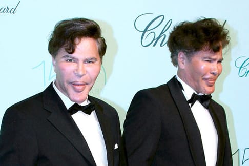 Igor und Grichka Bogdanoff haben es mit den Schönheits-OPs übertrieben.