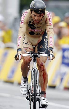 Das Tour-Debüt von Manuel Cardoso endete bereits beim Prolog. Der 27-Jährige von der Equipe Footon-Servetto brach sich den Kiefer und verletzte sich and der Schulter.
