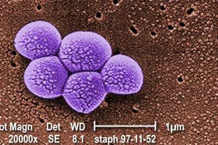 Einer der multiresistenten Viren, die für Infektionen, aber auch Lungenentzündungen und Blutvergiftungen verantwortlich sind.