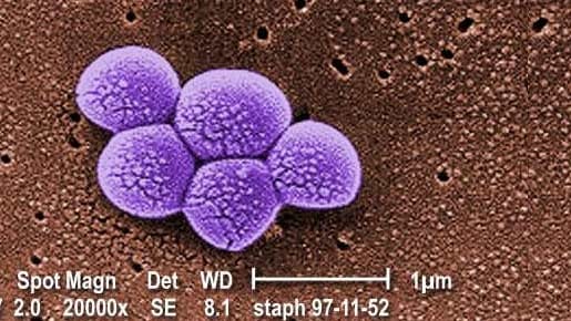 Einer der multiresistenten Viren, die für Infektionen, aber auch Lungenentzündungen und Blutvergiftungen verantwortlich sind. Einer der multiresistenten Viren, die für Infektionen, aber auch Lungenentzündungen und Blutvergiftungen verantwortlich sind.