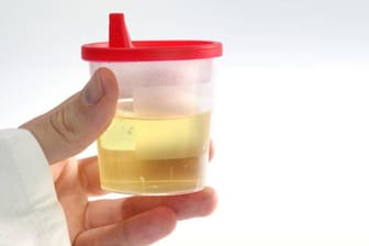 Können Lebensmittel den Alkoholgehalt im Urin verfälschen?