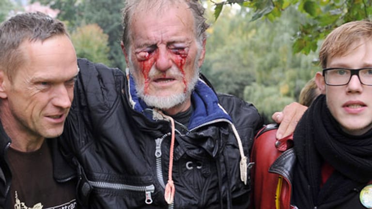 Dietrich Wagner erlitt durch den Strahl eines Wasserwerfers schwerste Augenverletzungen