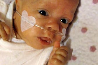 Ein Baby (Aufnahme vom 05.02.2011) hat in Dortmund mit einem Geburtsgewicht von lediglich 280 Gramm überlebt.