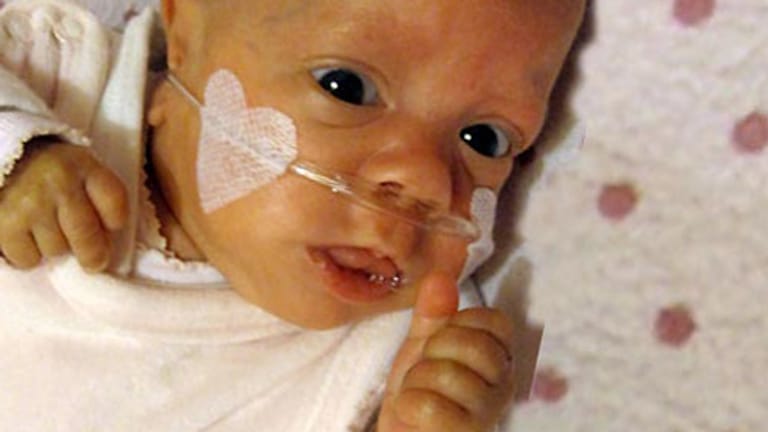 Ein Baby (Aufnahme vom 05.02.2011) hat in Dortmund mit einem Geburtsgewicht von lediglich 280 Gramm überlebt.