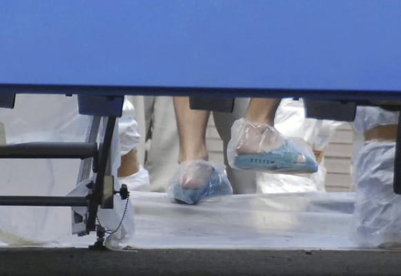 Das sind angeblich die Füße eines der Arbeiter, die im AKW Fukushima mit verstrahltem Wasser in Berührung kamen.
