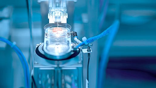 In Stuttgart wollen Forscher Haut industriell herstellen