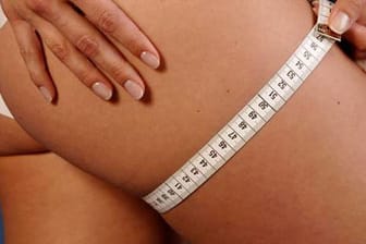 Fettabsaugung: Fett kann dem Fettabsaugen zurückkommen.