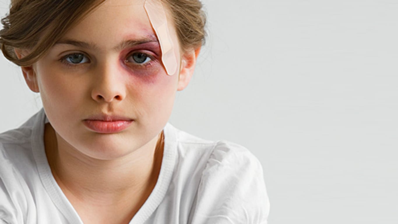 Häusliche Gewalt: Was kann man als Zeuge von Gewalt in der Familie tun?