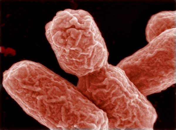 In schweren Fällen ruft das Bakterium das sogenannte hämolytisch-urämische Syndrom (HUS) hervor. Dieses kann zu lebensbedrohlichen Nieren- und anderen Organschäden führen
