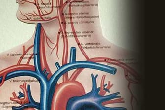 Arteriosklerose: Ursachen, Symptome und Behandlung einer Arterienverkalkung.
