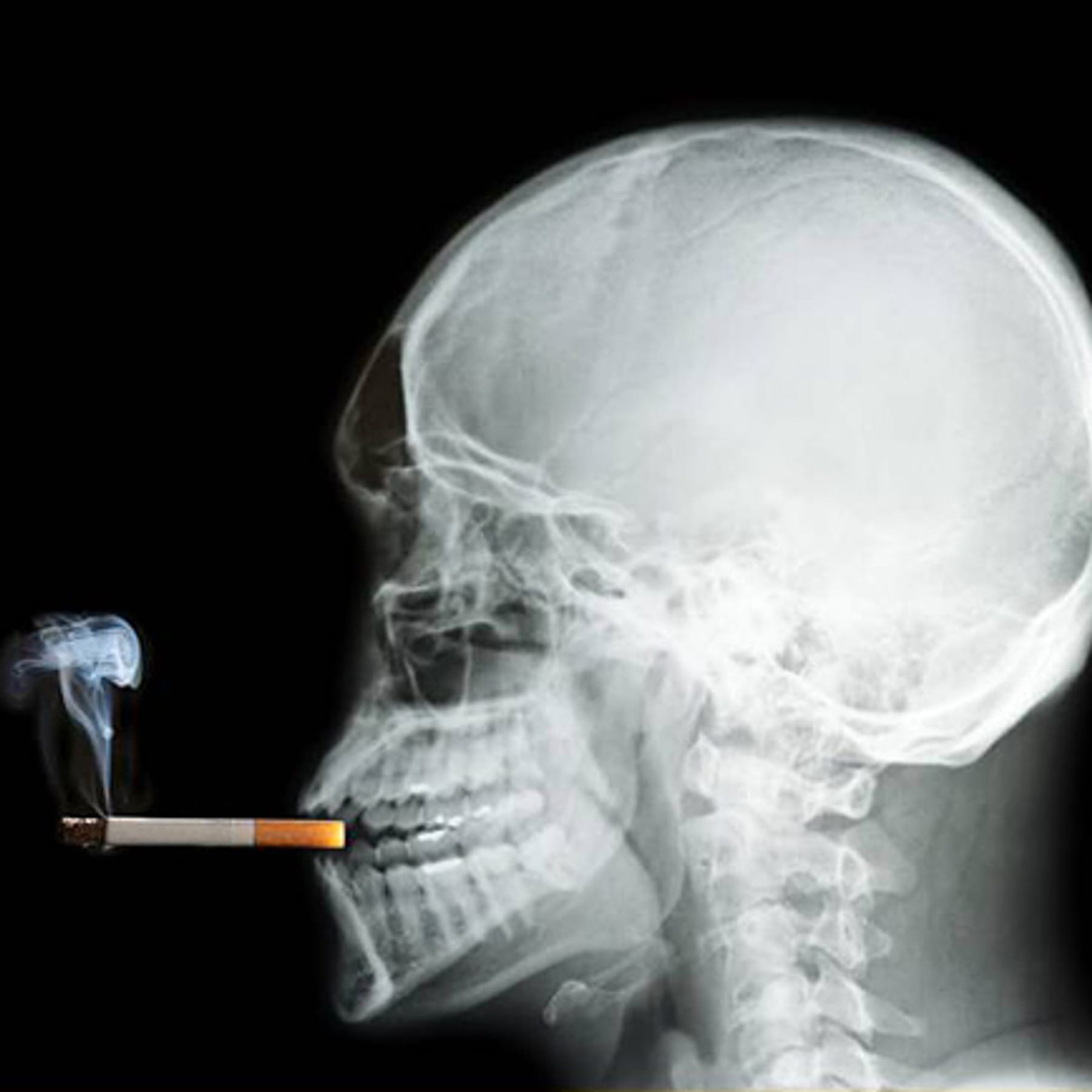 Können Nikotinpflaster und Co. bei der Rauchentwöhnung helfen?