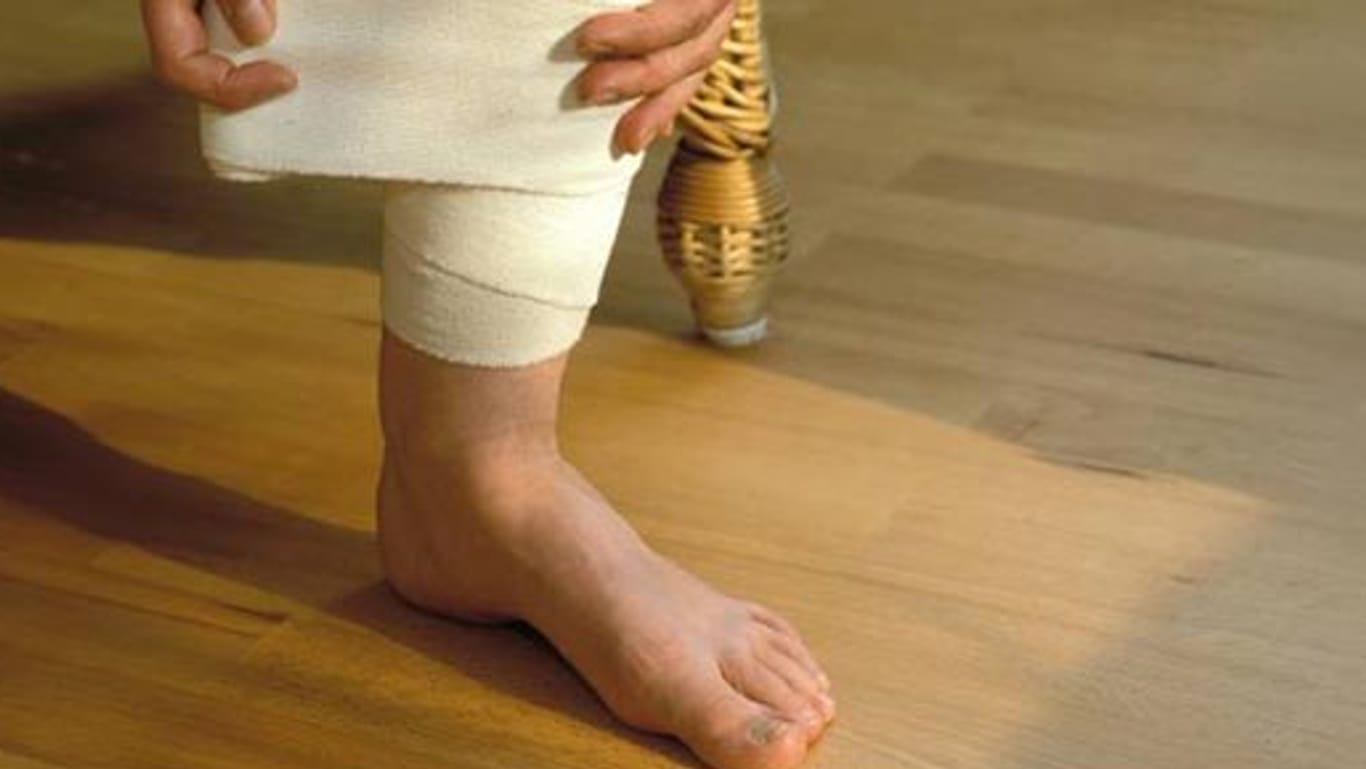 Ulcus cruris: Die Behandlung des offenen Beins ist oft langwierig.