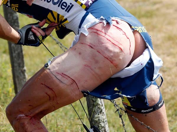 Die Tour de France gilt als das härteste Radrennen überhaupt. 2011 katapultiert ein ausscherender Begleitwagen Johnny Hoogerland von der Straße in einen Stacheldrahtzaun. Der Niederländer steigt trotz vieler tiefer Schnittwunden wieder auf sein Rad und quält sich zum Ziel. Dort gewinnt er auch noch das Bergtrikot, das er unter Tränen entgegennimmt. Hoogerland muss mit 33 Stichen genäht werden und fährt die Tour zu Ende. "Ich bin froh, dass ich noch am Leben bin", sagt er.