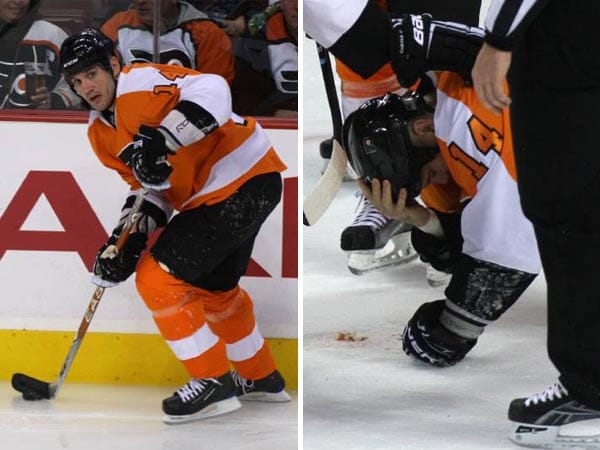 Von einem Schlagschuss wird der Eishockey-Spieler Ian Laperriere beim Spiel seiner Philadelphia Flyers gegen die Buffalo Sabres 2009 im ersten Drittel am Mund getroffen. Er wird mit 50 bis 100 Stichen genäht und steht im letzten Drittel wieder auf dem Eis.