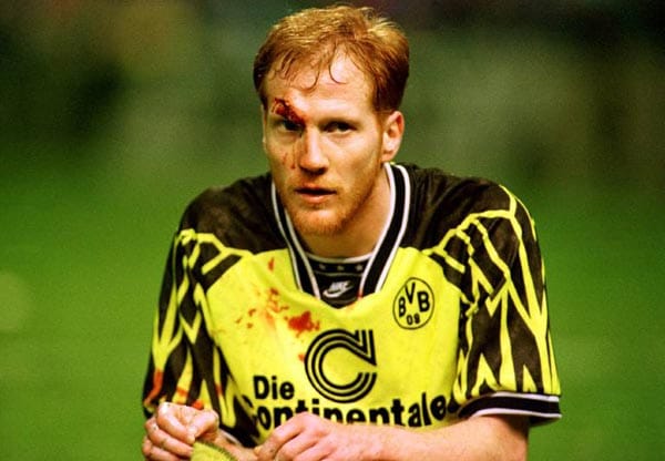 Matthias Sammer von Borussia Dortmund zieht sich 1994 gegen Borussia Mönchengladbach eine Platzwunde an der Stirn zu. Sammer wird auf dem Platz getackert und spielt weiter. Die Narbe ist bis heute noch zu sehen.