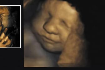 4D-Aufnahmen zeigen: Bereits im Mutterleib entwickeln Kinder ihre Mimik.