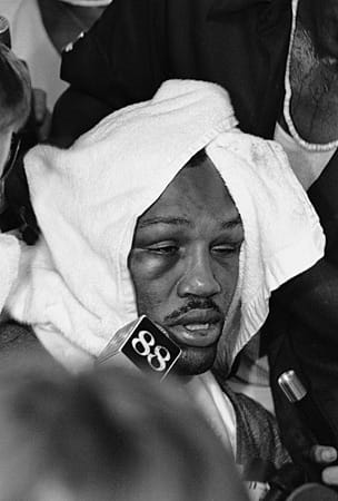 Im dritten und letzten Kampf gegen Ali 1975 musste Frazier mit einem dick geschwollenen Auge aufgeben. Die Niederlage bedeutete praktisch das Ende seiner Karriere.