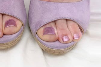 Eingewachsener Fußnagel: Enges und unbequemes Schuhwerk ist häufig die Ursache.