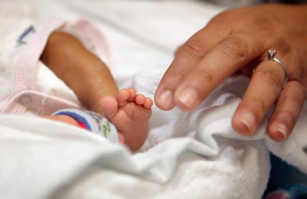Die kleine Melinda musste in der 24. Schwangerschaftswoche, drei Monate vor dem eigentlichen Geburtstermin, geholt werden.