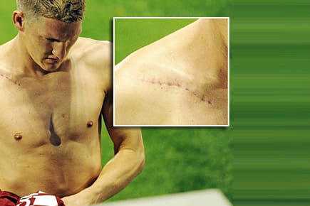 Bastian Schweinsteiger zeigt erstmals seine Narbe in der Öffentlichkeit.