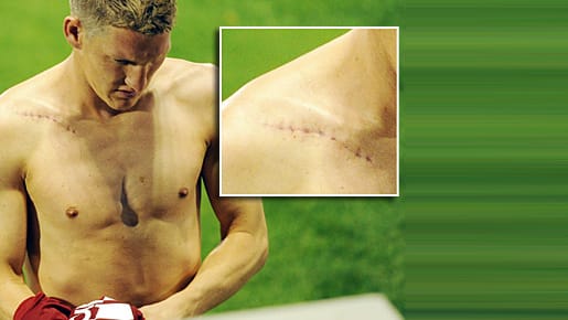 Bastian Schweinsteiger zeigt erstmals seine Narbe in der Öffentlichkeit.