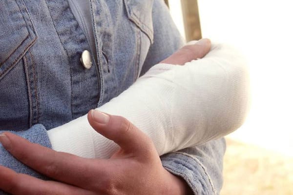 Ein gebrochener Arm hat größere Auswirkungen auf den Organismus als bisher bekannt