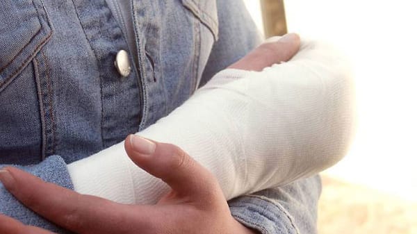 Ein gebrochener Arm hat größere Auswirkungen auf den Organismus als bisher bekannt Ein gebrochener Arm hat größere Auswirkungen auf den Organismus als bisher bekannt