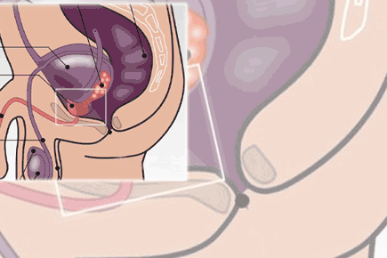 Klicken Sie aufs Bild, um die interaktive Grafik zu starten: So wichtig ist die Prostata für den Mann.