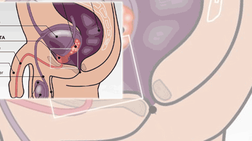 Klicken Sie aufs Bild, um die interaktive Grafik zu starten: So wichtig ist die Prostata für den Mann.