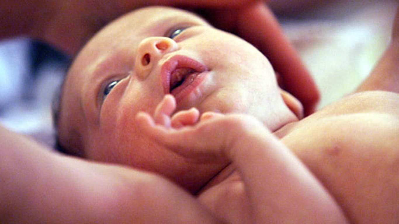 Immer mehr Babys erblicken nach einem Kaiserschnitt das Licht der Welt.