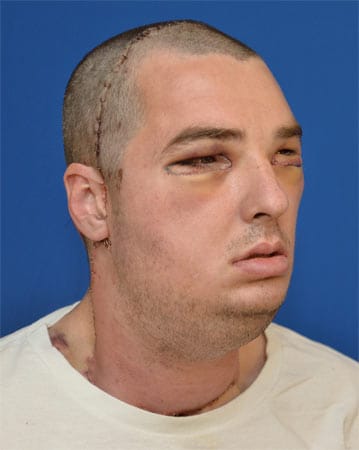 Der 37-jährige US-Patient Richard Lee Norris hat ein komplett neues Gesicht bekommen. Der 37-jährige US-Patient Richard Lee Norris hat ein komplett neues Gesicht bekommen.