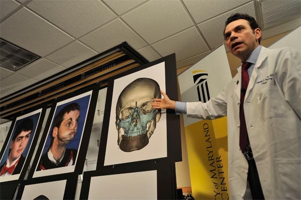 In einem 36-stündigen Eingriff verpflanzten Ärzte des Universitätsklinikums von Maryland um Eduardo D. Rodriguez (im Bild) Norris ein vollständiges Gesicht vom Haaransatz bis zum Hals sowie Ober- und Unterkiefer, Zähne und Zunge. In einem 36-stündigen Eingriff verpflanzten Ärzte des Universitätsklinikums von Maryland um Eduardo D. Rodriguez (im Bild) Norris ein vollständiges Gesicht vom Haaransatz bis zum Hals sowie Ober- und Unterkiefer, Zähne und Zunge.
