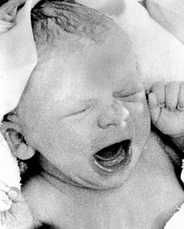 Louise Joy Brown kurz nach ihrer Geburt im Juli 1978 in Oldham. Mit ihrer Geburt wurde ein neues Kapitel in der Medizingeschichte aufgeschlagen: Die heute 33 Jahre alte Britin Louise Brown ist das erste Retortenbaby der Welt.