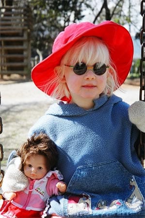 Lydia (heute 10) leidet an Albinismus, einer genetisch bedingten Stoffwechselerkrankung.