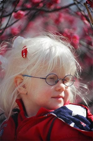 Albinismus geht mit einer Verminderung des Farbstoffs Melanin einher. Dies wirkt sich vor allem auf die Augen aus, deshalb sind die Betroffenen stark sehbehindert.