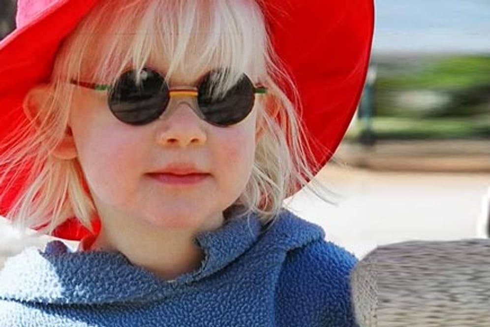 Albinismus: Lydia (10) ist durch den Albinismus stark sehbehindert.
