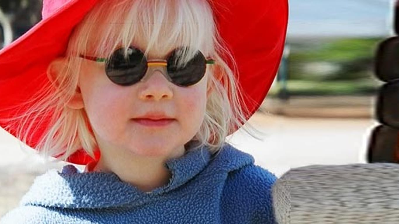 Albinismus: Lydia (10) ist durch den Albinismus stark sehbehindert.