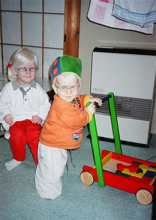 Albinisten benötigen schon sehr früh eine Brille, weil die Augen meist von starker Weitsichtigkeit und Hornhautverkrümmung betroffen sind.