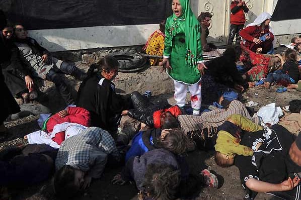 Massoud Hossaini hielt diesen Moment nach einem Selbstmordanschlag in Afghanistan bildlich fest