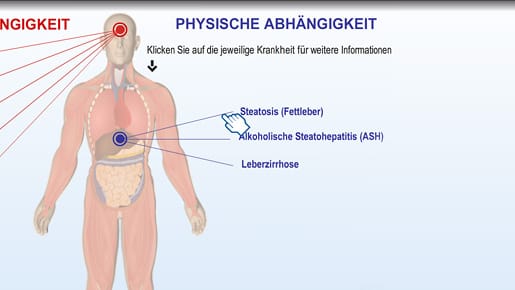 Klick aufs Bild: So schlimm sind die Folgen von Alkohol.