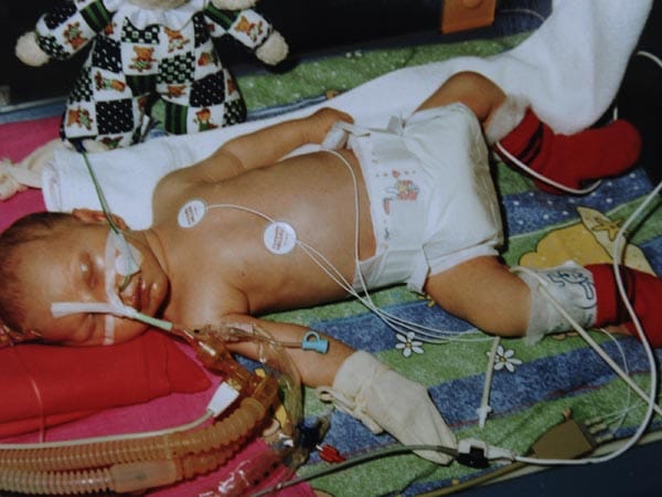 Schon kurzer Zeit nach der komplikationslosen Geburt erhalten Jens' Eltern die schreckliche Diagnose: Ihr Sohn wurde mit einem unheilbaren Herzfehler geboren - ihm fehlt die linke Herzkammer.