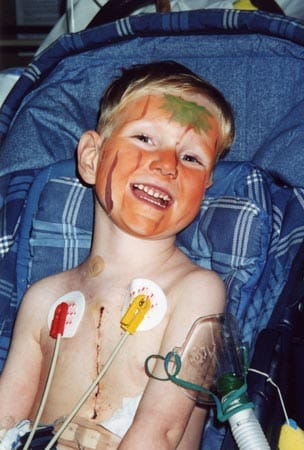 Die Leiden der letzten fünf Jahre sind diesem fröhlichen Jungen kaum anzusehen. Doch die große Narbe auf seinem Körper zeigt, dass er gerade eine Herztransplantation hinter sich hat.