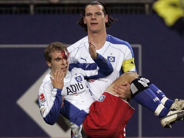 Alexander Laas wird von seinem Team-Kollegen Daniel van Buyten vom Platz getragen. Laas wurde während eines Torjubels seiner Hamburger im Heimspiel gegen den 1. FC Köln (Saison 2005/2006) von einem Trommelstock am Kopf getroffen und verletzt.