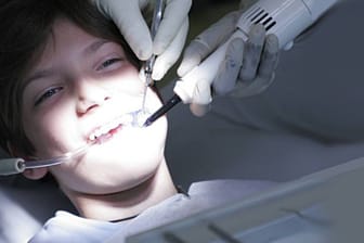 Bohren ist Routine, doch eine Zahn-OP unter Vollnarkose birgt bei Kindern Risiken.
