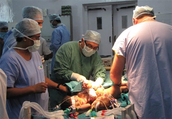 Ein internationales Team von 30 Ärzten versucht in einer riskanten Operation, die Zwillinge zu trennen.