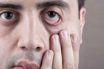 Symptome: Krankheiten am Auge erkennen.